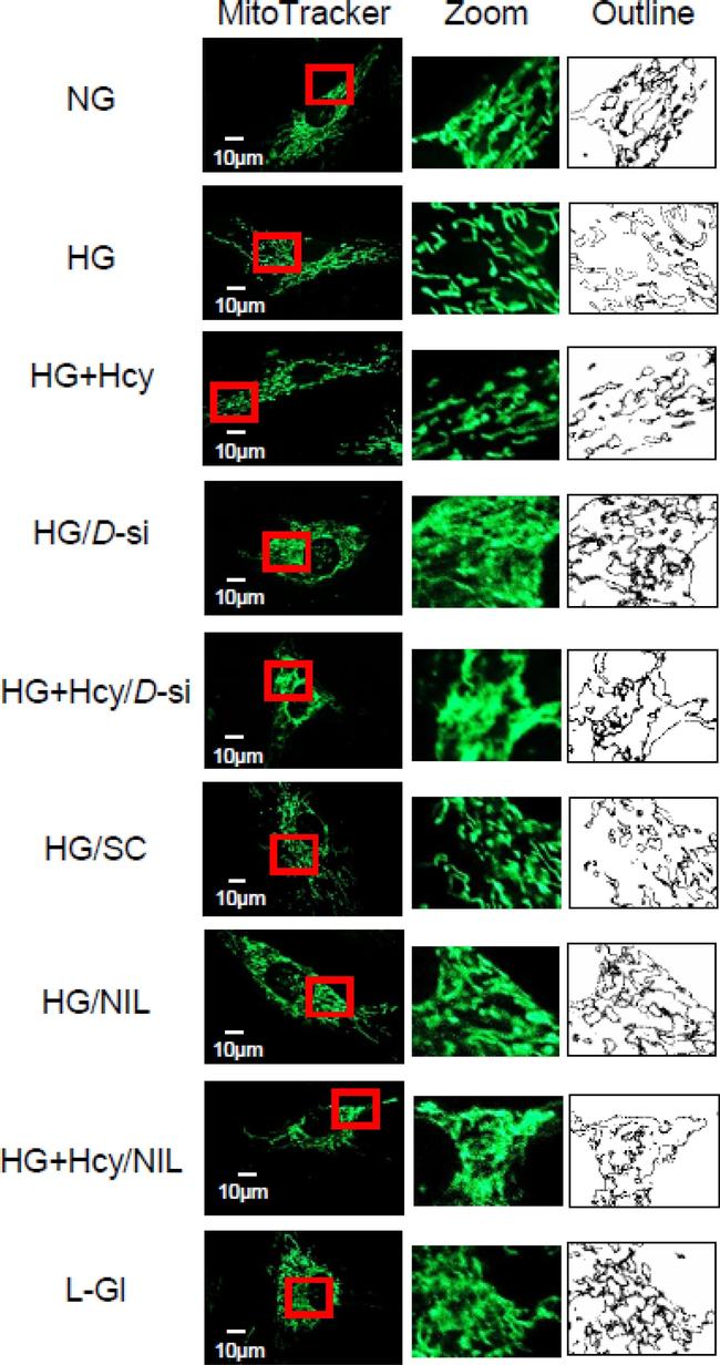 Rabbit IgG (H+L) Cross-Adsorbed Secondary Antibody in Immunocytochemistry (ICC/IF)