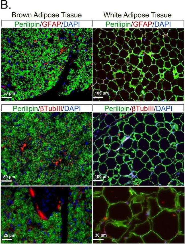 Rabbit IgG (H+L) Highly Cross-Adsorbed Secondary Antibody in Immunohistochemistry (Paraffin) (IHC (P))