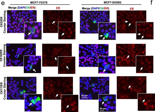 Rabbit IgG (H+L) Cross-Adsorbed Secondary Antibody in Immunocytochemistry (ICC/IF)