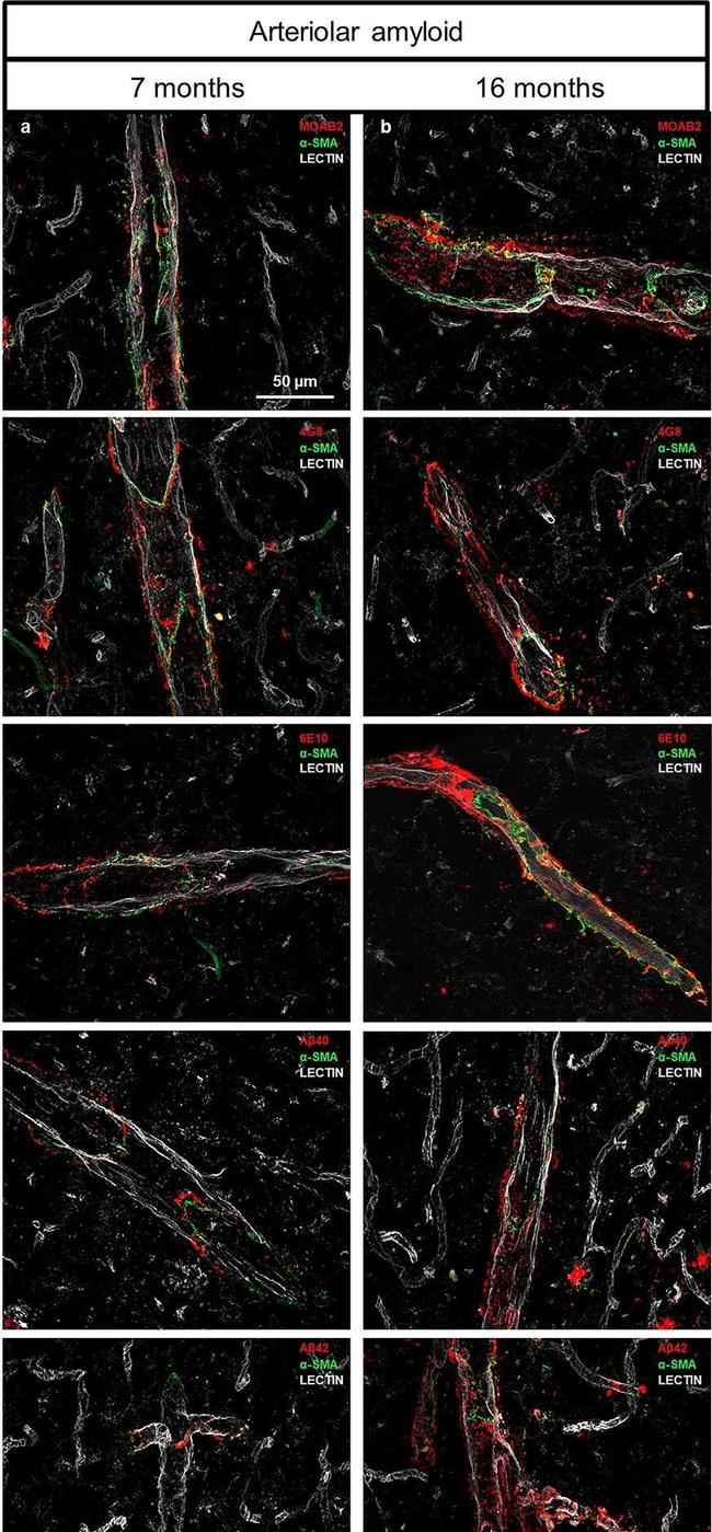 Mouse IgG (H+L) Highly Cross-Adsorbed Secondary Antibody in Immunohistochemistry (IHC)