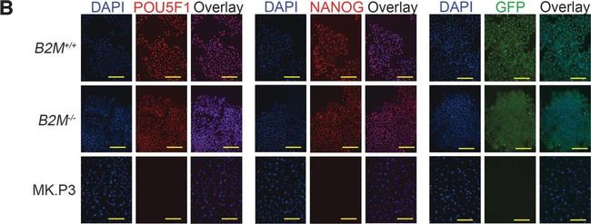 Rabbit IgG (H+L) Cross-Adsorbed Secondary Antibody in Immunocytochemistry (ICC/IF)