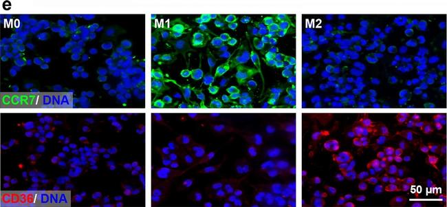 Rabbit IgG (H+L) Highly Cross-Adsorbed Secondary Antibody in Immunocytochemistry (ICC/IF)