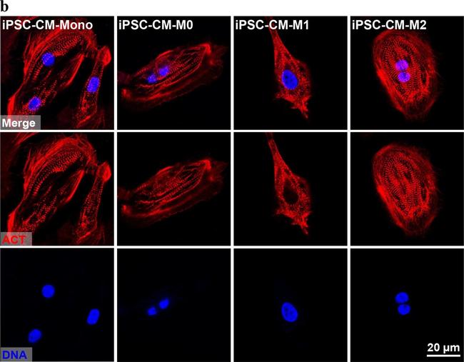 Rabbit IgG (H+L) Cross-Adsorbed Secondary Antibody in Immunocytochemistry (ICC/IF)