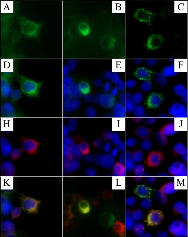 Rabbit IgG (H+L) Cross-Adsorbed Secondary Antibody in Immunocytochemistry (ICC/IF)