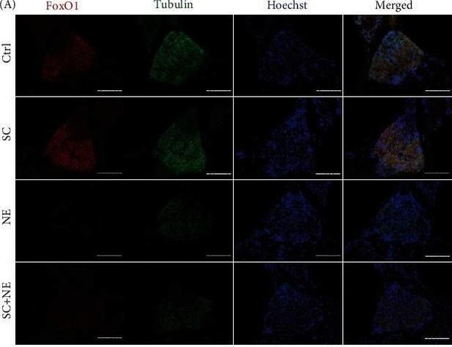 Mouse IgG (H+L) Highly Cross-Adsorbed Secondary Antibody in Immunohistochemistry (Paraffin) (IHC (P))