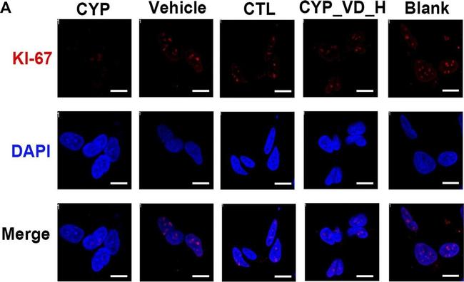 Rabbit IgG (H+L) Cross-Adsorbed Secondary Antibody in Immunocytochemistry (ICC/IF)