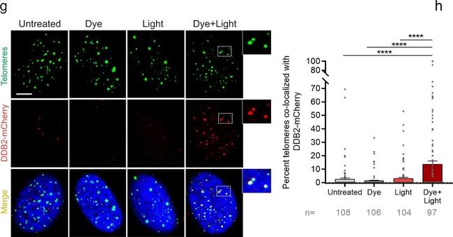 Mouse IgG (H+L) Highly Cross-Adsorbed Secondary Antibody in Immunocytochemistry (ICC/IF)