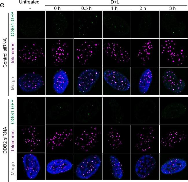 Mouse IgG (H+L) Highly Cross-Adsorbed Secondary Antibody in Immunocytochemistry (ICC/IF)