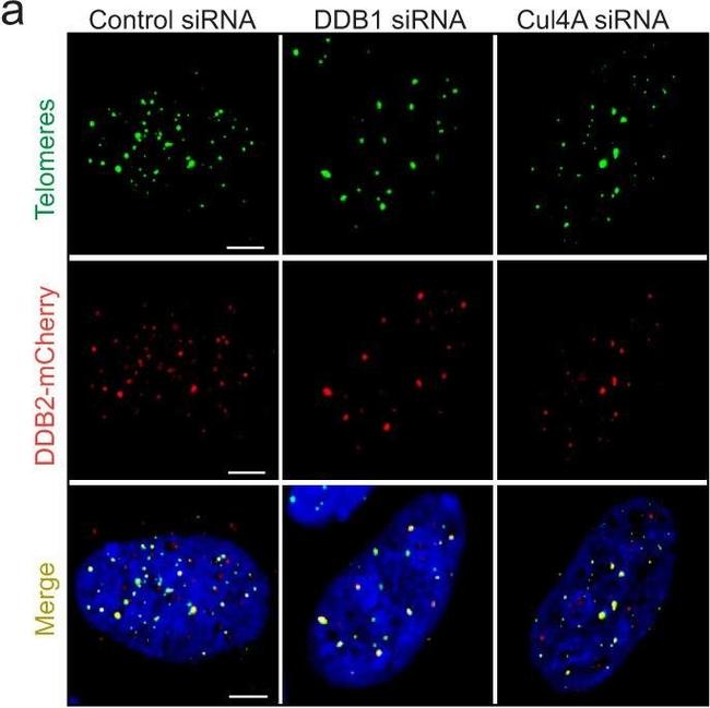 Mouse IgG (H+L) Highly Cross-Adsorbed Secondary Antibody in Immunocytochemistry (ICC/IF)