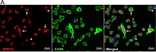 Rabbit IgG (H+L) Cross-Adsorbed Secondary Antibody in Immunocytochemistry (ICC/IF)