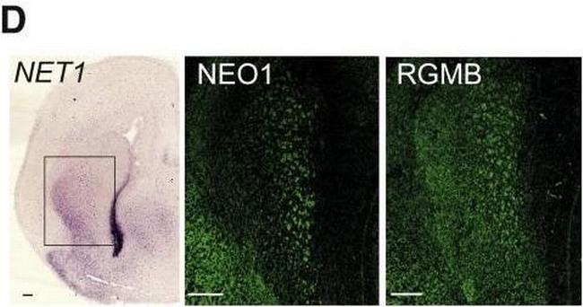 Sheep IgG (H+L) Cross-Adsorbed Secondary Antibody in Immunohistochemistry (IHC)