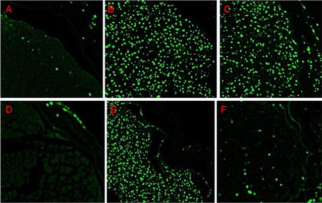 Mouse IgG (H+L) Highly Cross-Adsorbed Secondary Antibody in Immunohistochemistry (Paraffin) (IHC (P))