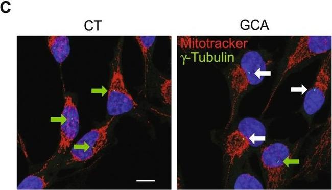 Mouse IgG (H+L) Highly Cross-Adsorbed Secondary Antibody in Immunocytochemistry (ICC/IF)