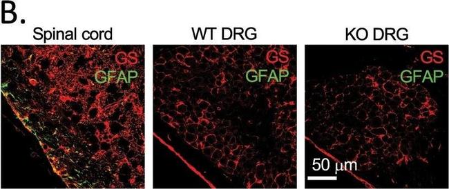 Mouse IgG (H+L) Highly Cross-Adsorbed Secondary Antibody in Immunohistochemistry (Paraffin) (IHC (P))