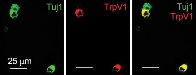 Mouse IgG (H+L) Highly Cross-Adsorbed Secondary Antibody in Immunocytochemistry (ICC/IF)