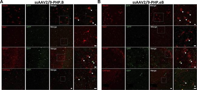 Mouse IgG (H+L) Highly Cross-Adsorbed Secondary Antibody in Immunohistochemistry (IHC)