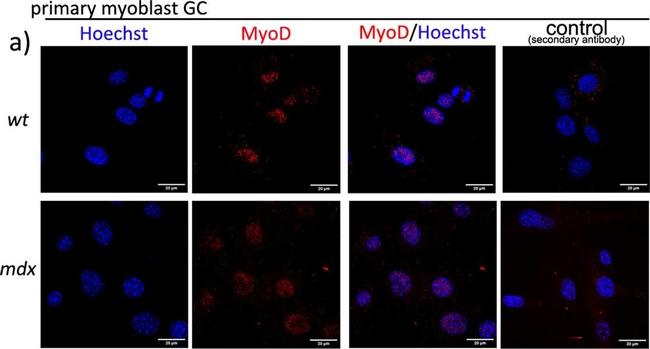 Mouse IgG (H+L) Highly Cross-Adsorbed Secondary Antibody in Immunocytochemistry (ICC/IF)