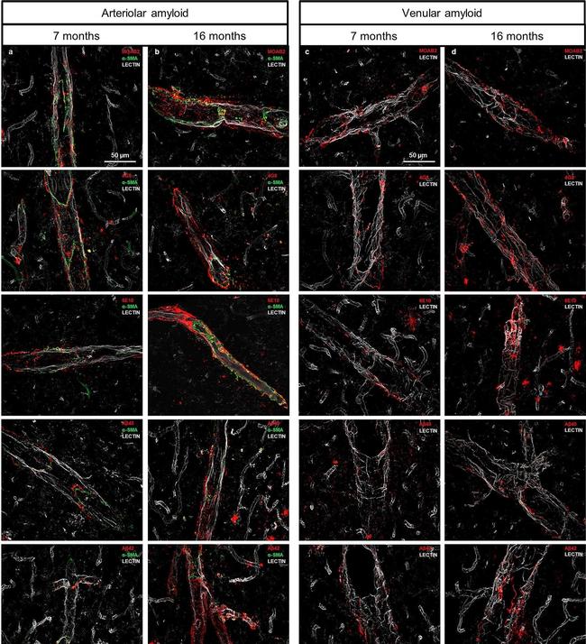 Mouse IgG (H+L) Highly Cross-Adsorbed Secondary Antibody in Immunohistochemistry (IHC)