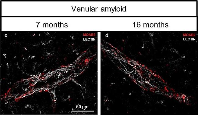 Mouse IgG (H+L) Highly Cross-Adsorbed Secondary Antibody in Immunohistochemistry (IHC)