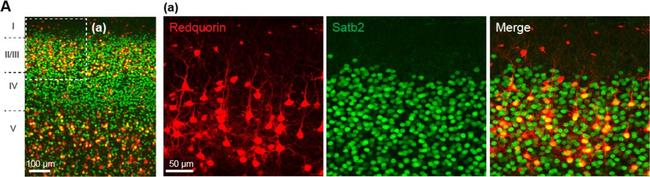 Rat IgG (H+L) Cross-Adsorbed Secondary Antibody in Immunohistochemistry (PFA fixed) (IHC (PFA))