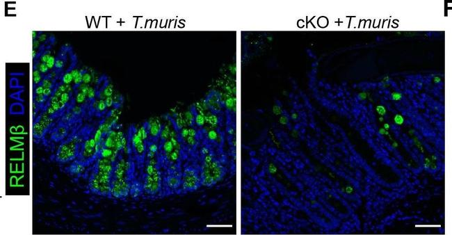 Mouse IgG (H+L) Highly Cross-Adsorbed Secondary Antibody in Immunohistochemistry (PFA fixed) (IHC (PFA))