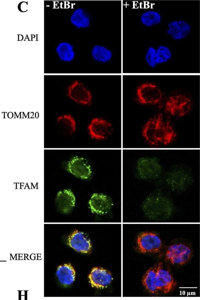 Rabbit IgG (H+L) Highly Cross-Adsorbed Secondary Antibody in Immunocytochemistry (ICC/IF)