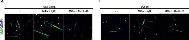 Mouse IgG (H+L) Highly Cross-Adsorbed Secondary Antibody in Immunocytochemistry (ICC/IF)