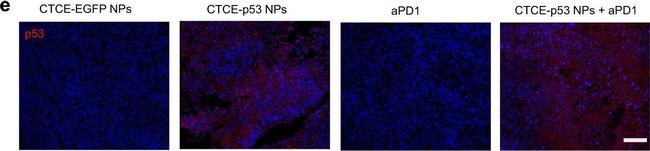 Mouse IgG (H+L) Secondary Antibody in Immunocytochemistry (ICC/IF)