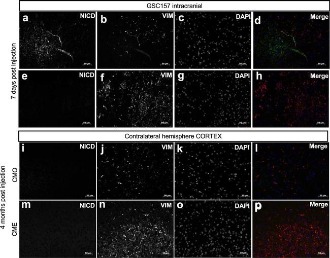 Goat IgG (H+L) Highly Cross-Adsorbed Secondary Antibody in Immunohistochemistry (Paraffin) (IHC (P))