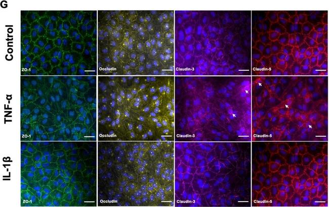 Rabbit IgG (H+L) Highly Cross-Adsorbed Secondary Antibody in Immunocytochemistry (ICC/IF)