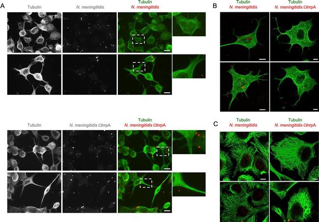 Rabbit IgG (H+L) Highly Cross-Adsorbed Secondary Antibody in Immunocytochemistry (ICC/IF)