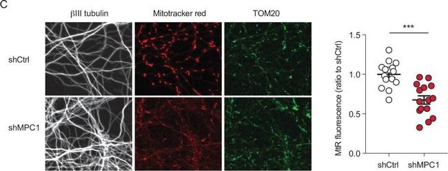 Mouse IgG (H+L) Highly Cross-Adsorbed Secondary Antibody in Immunohistochemistry (PFA fixed) (IHC (PFA))