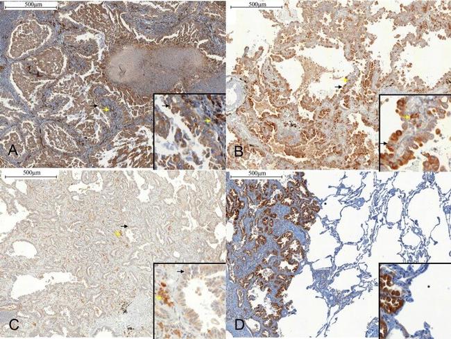 MMP13 Antibody in Immunohistochemistry (Paraffin) (IHC (P))