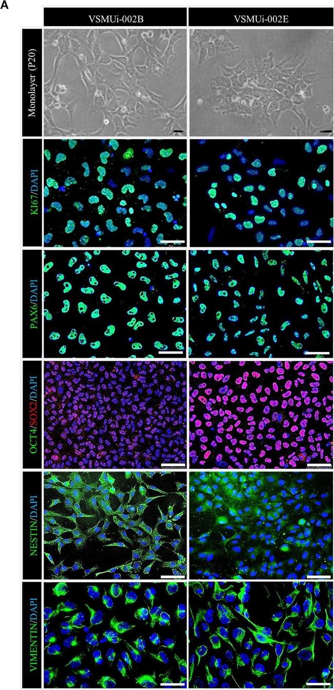 Rabbit IgG (H+L) Highly Cross-Adsorbed Secondary Antibody in Immunocytochemistry (ICC/IF)