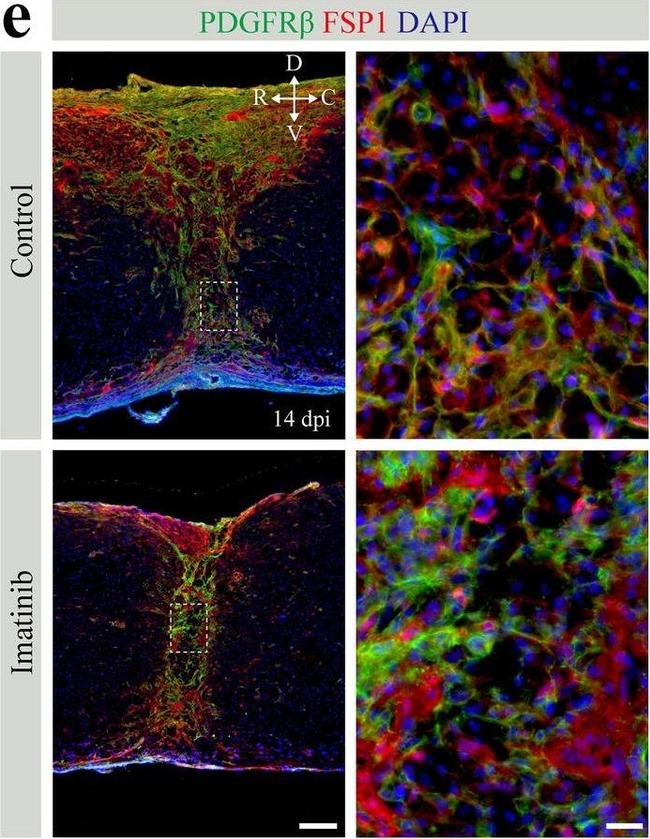 Rat IgG (H+L) Highly Cross-Adsorbed Secondary Antibody in Immunohistochemistry (IHC)