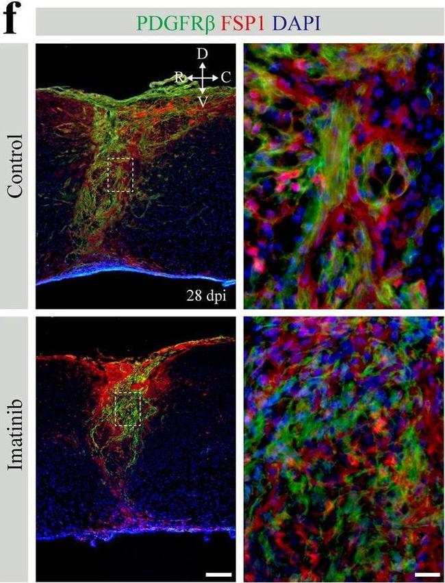 Rat IgG (H+L) Highly Cross-Adsorbed Secondary Antibody in Immunohistochemistry (IHC)