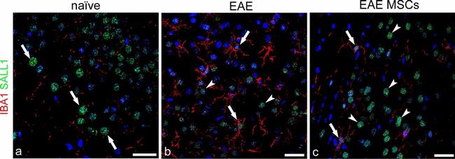 Rabbit IgG (H+L) Cross-Adsorbed Secondary Antibody in Immunohistochemistry (IHC)