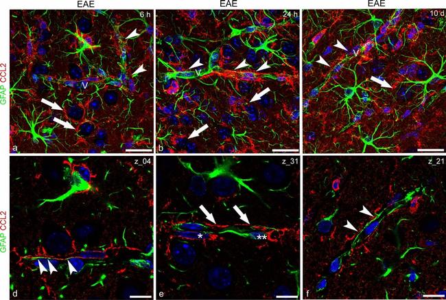 Rabbit IgG (H+L) Cross-Adsorbed Secondary Antibody in Immunohistochemistry (IHC)