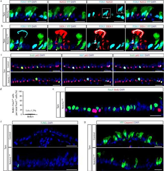 SSEA1 Antibody in Immunohistochemistry (IHC)