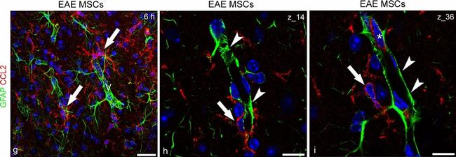 Rabbit IgG (H+L) Cross-Adsorbed Secondary Antibody in Immunohistochemistry (IHC)