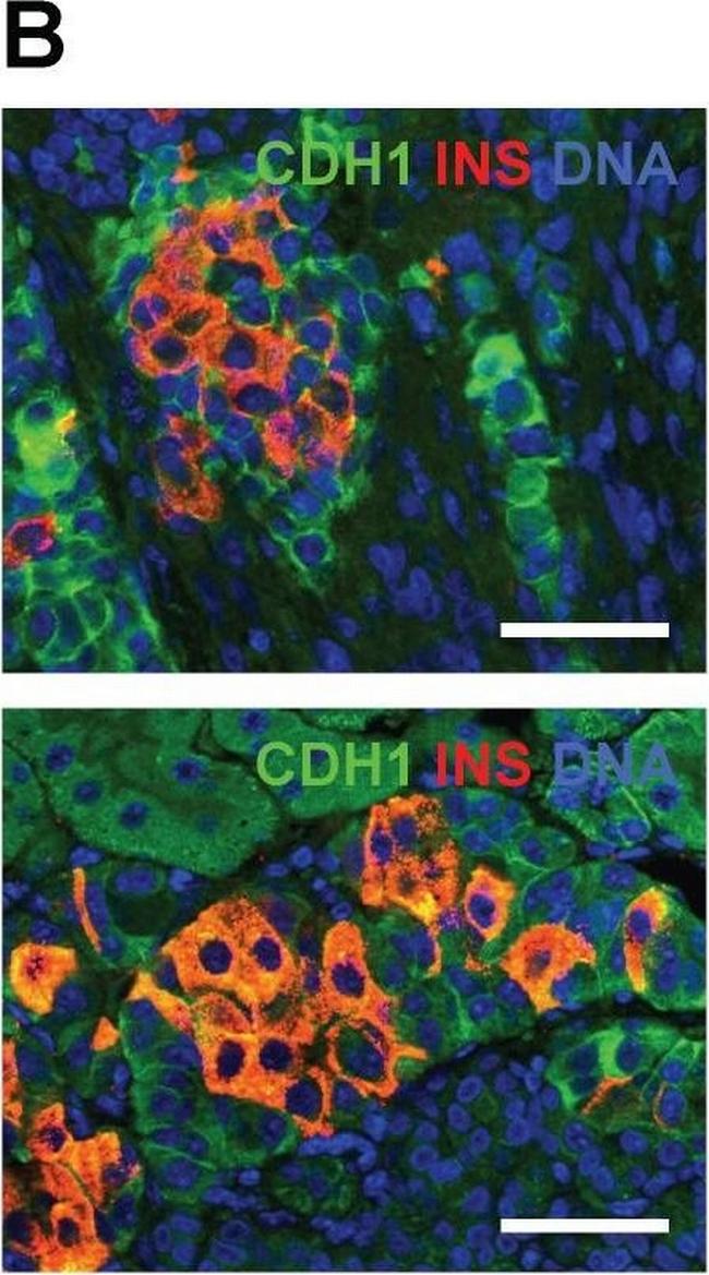 Mouse IgG (H+L) Highly Cross-Adsorbed Secondary Antibody in Immunohistochemistry (Paraffin) (IHC (P))