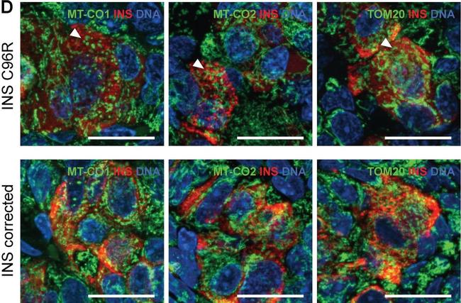 Mouse IgG (H+L) Highly Cross-Adsorbed Secondary Antibody in Immunohistochemistry (Paraffin) (IHC (P))