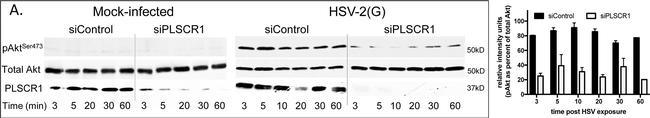 Goat IgG (H+L) Cross-Adsorbed Secondary Antibody in Western Blot (WB)