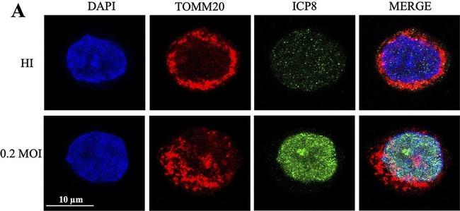 Rabbit IgG (H+L) Cross-Adsorbed Secondary Antibody in Immunocytochemistry (ICC/IF)