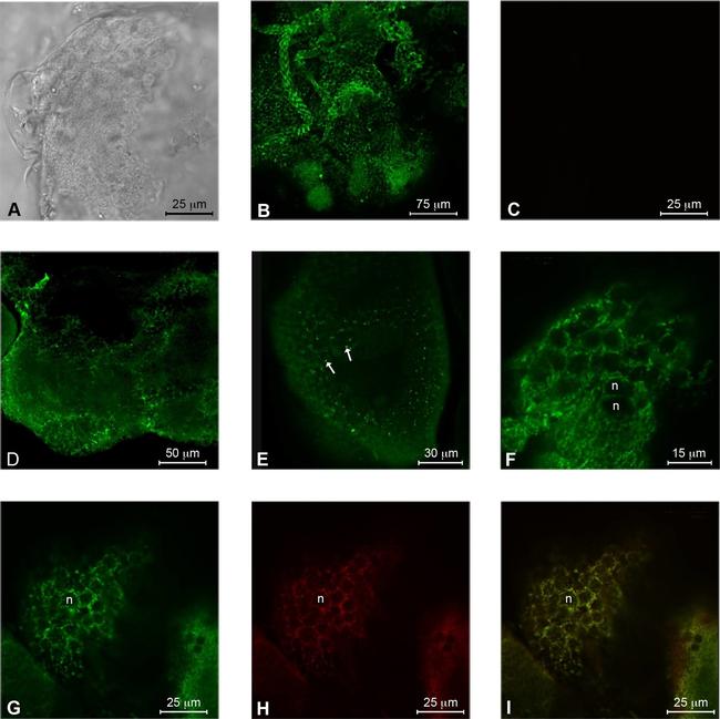 Rabbit IgG (H+L) Highly Cross-Adsorbed Secondary Antibody in Immunohistochemistry (PFA fixed) (IHC (PFA))