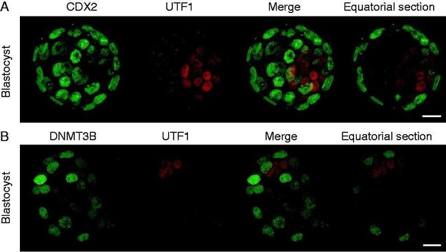 Rabbit IgG (H+L) Highly Cross-Adsorbed Secondary Antibody in Immunohistochemistry (PFA fixed) (IHC (PFA))