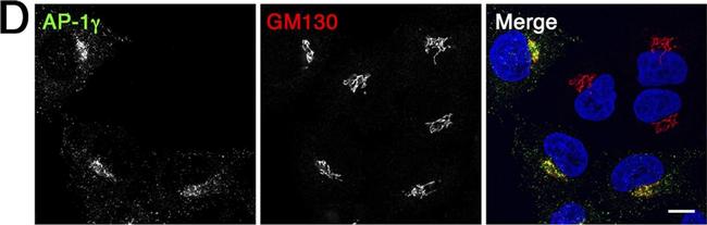 Rabbit IgG (H+L) Highly Cross-Adsorbed Secondary Antibody in Immunocytochemistry (ICC/IF)