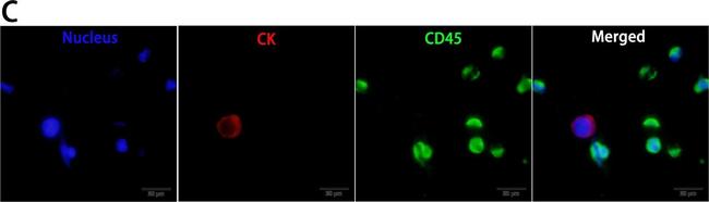 Mouse IgG (H+L) Highly Cross-Adsorbed Secondary Antibody in Immunocytochemistry (ICC/IF)