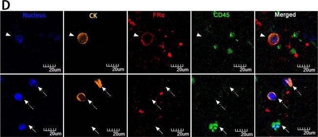 Mouse IgG (H+L) Highly Cross-Adsorbed Secondary Antibody in Immunocytochemistry (ICC/IF)