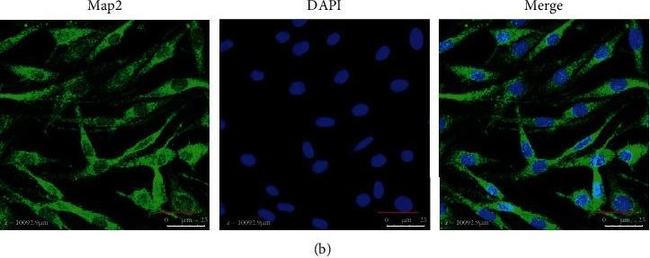 Mouse IgG (H+L) Highly Cross-Adsorbed Secondary Antibody in Immunocytochemistry (ICC/IF)